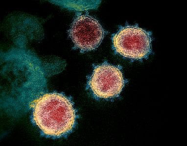 Khối cầu gai khuynh đảo thế giới: Thấy gì từ bức hình minh họa 3D nổi tiếng của virus SARS-CoV-2? - Ảnh 1.