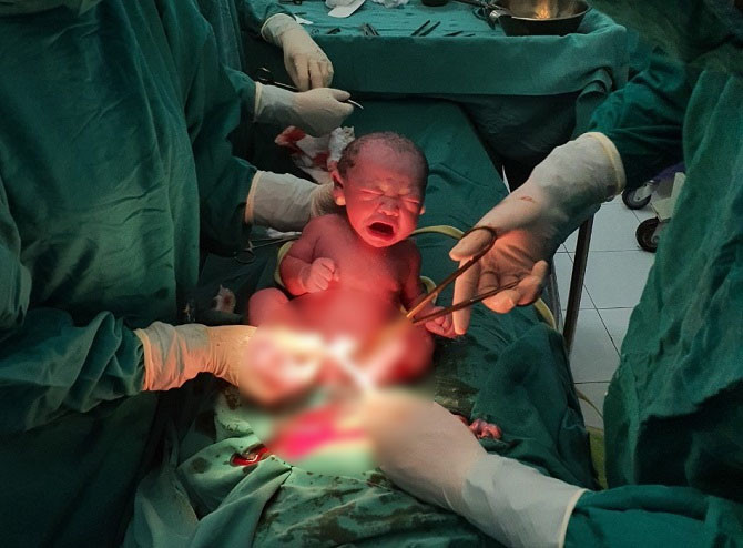 Mổ cấp cứu thai phụ bị suy thai cấp, vỡ tử cung, bé gái nặng 3,2kg chào đời khỏe mạnh - Ảnh 1.