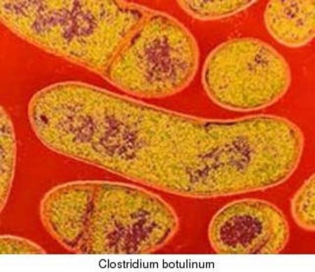 Phòng, chống ngộ độc thực phẩm do vi khuẩn Clostridium botulinum - Ảnh 1.