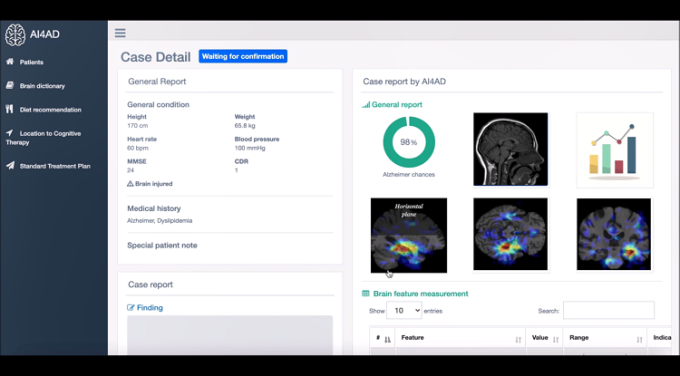 Tiến sĩ tạo phần mềm AI chẩn đoán bệnh Alzheimer trong 10 phút - Ảnh 2.