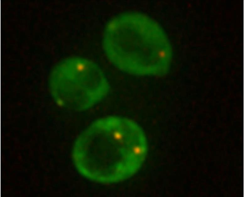 scitechdaily.com-images-_assembly-of-cytoplasmic-rnp-condensates-in-yeast-cells-777x777(1).jpg