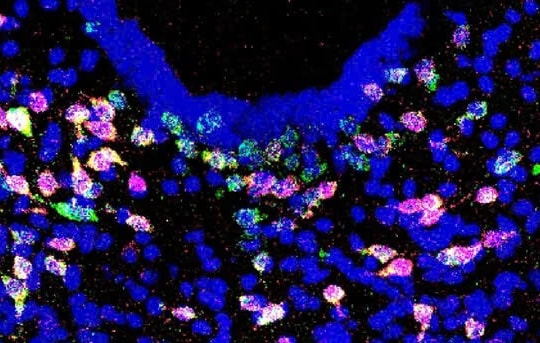 Tín hiệu “dừng ăn” từ não bộ mở ra hướng điều trị béo phì mới