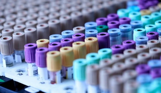 Công cụ AI chẩn đoán bệnh tiểu đường, HIV và COVID từ mẫu máu: Bước đột phá trong y học chính xác