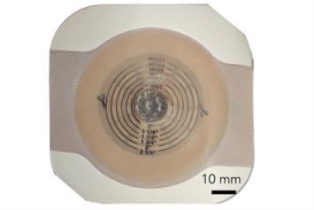 Băng gạc tích hợp AI và camera đẩy nhanh quá trình lành vết thương