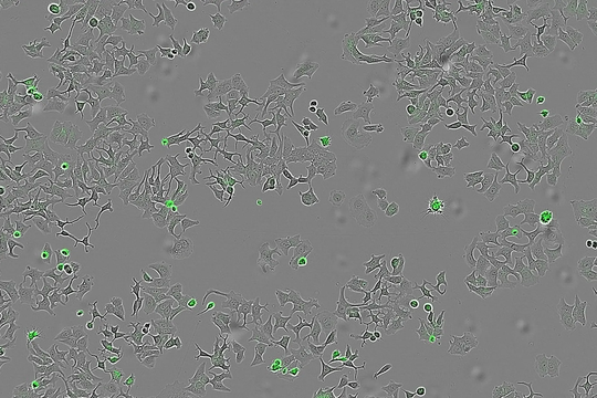 ‏Các nhà khoa học Tây Ban Nha tìm ra protein “diệt” ung thư‏