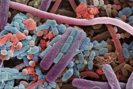 Bổ sung men vi sinh có thực sự cần thiết?