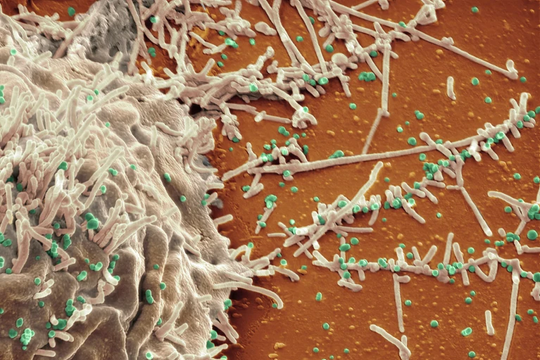 Liệu pháp kháng thể mở ra hy vọng điều trị cúm gia cầm và HIV