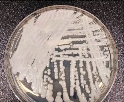 Phát hiện mới mở ra các đích tiềm năng cho kiểm soát dịch và phát triển thuốc điều trị nhiễm trùng do Candida auris