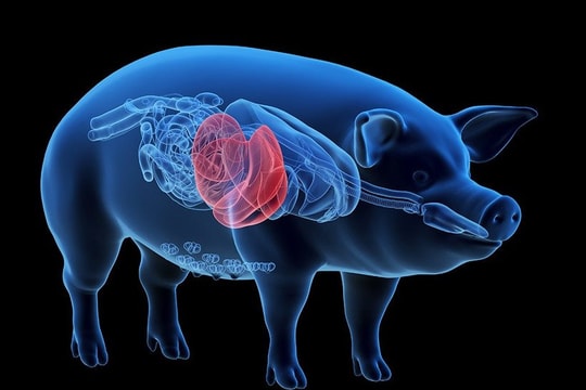 Nối gan lợn với mạch máu ở chân, giúp cứu sống người đàn ông chờ ghép tạng