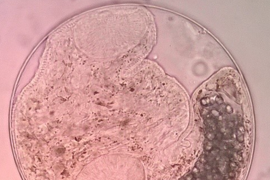 Mô hình một sức khỏe mở hướng kiểm soát ký sinh trùng miền núi phía Bắc