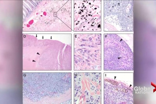 Interstitium - Mô kẽ: “Cơ quan mới” của Tây Y và lời giải mã khoa học cho hệ kinh lạc ngàn năm
