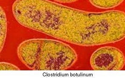 Phòng, chống ngộ độc thực phẩm do vi khuẩn Clostridium botulinum