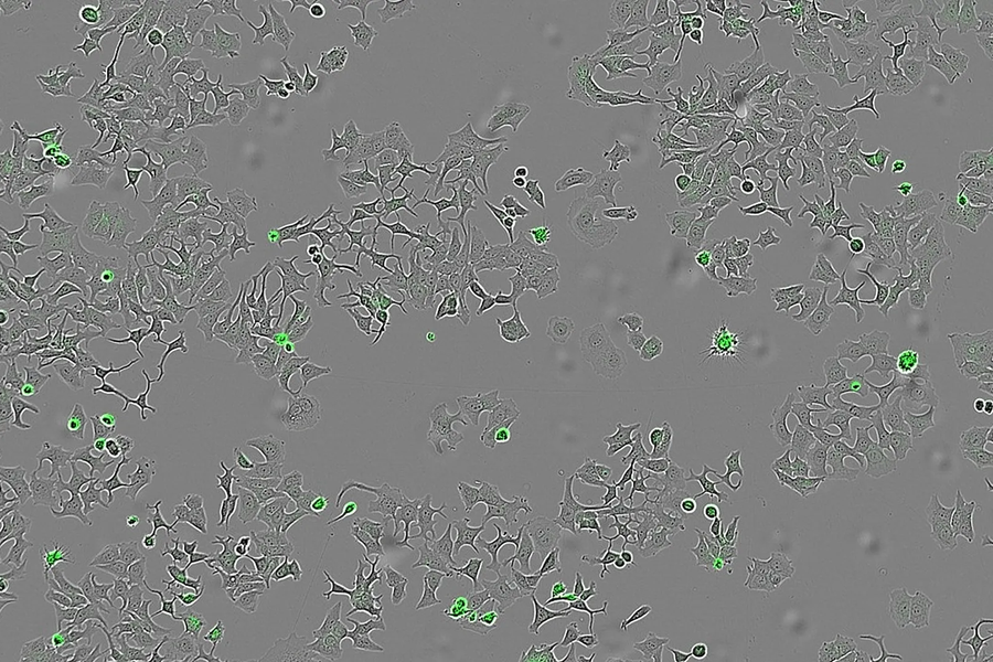 ‏Các nhà khoa học Tây Ban Nha tìm ra protein “diệt” ung thư‏