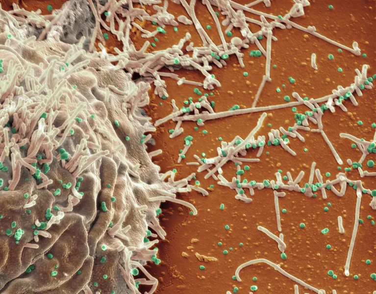 Liệu pháp kháng thể mở ra hy vọng điều trị cúm gia cầm và HIV